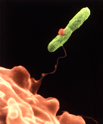 A microscopic view of <i>Legionella</i> bacteria (in green). It is transmitted via water vapor.