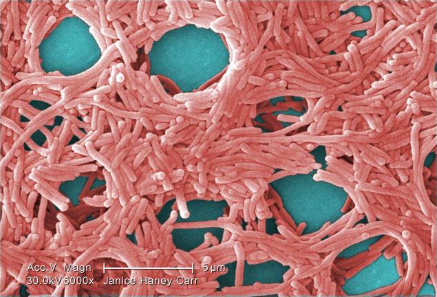 Two more people hospitalized in connection with a UES Legionnaires’ outbreak last month have now died, bringing the total death toll to nine. The outbreak itself, however, was eliminated weeks ago.